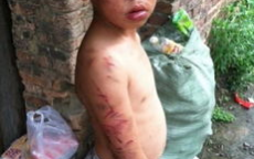 14岁少年惨遭虐致死，小区业主物业联名发声揭露真相